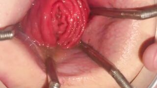 Getting my mancunt spread WIDE by huge anal speculum!