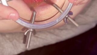 Getting my mancunt spread WIDE by huge anal speculum!