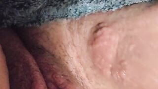 Heat Rashes are No Fun.